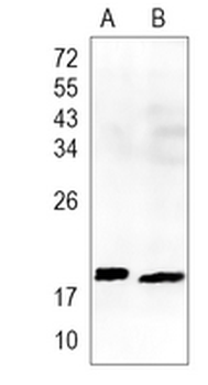 Troponin C Rabbit Monoclonal Antibody