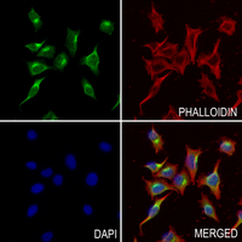 MYL9 Rabbit Monoclonal Antibody