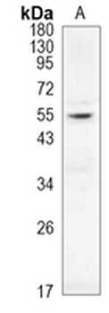 AKT (Phospho-T450) Rabbit Monoclonal Antibody