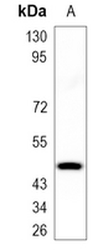 FOSB Rabbit Monoclonal Antibody