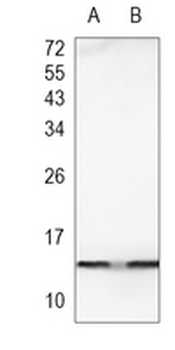 Histone H2A (Acetyl-K9) Rabbit Monoclonal Antibody