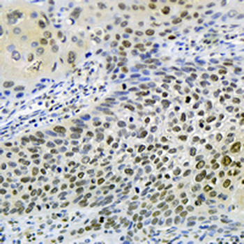 Histone H2A (Acetyl-K9) Rabbit Monoclonal Antibody