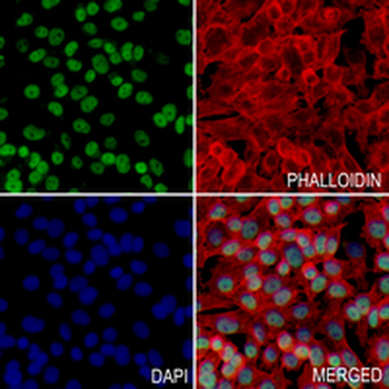 Histone H2A (Acetyl-K9) Rabbit Monoclonal Antibody