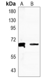 ALB Rabbit Monoclonal Antibody