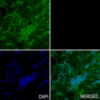 ALB Rabbit Monoclonal Antibody