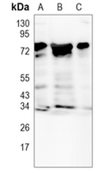 Metadherin Rabbit Monoclonal Antibody