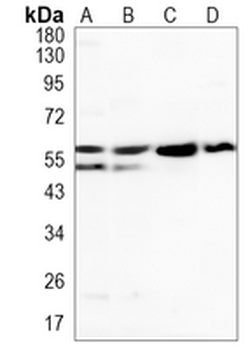 PDI Rabbit Monoclonal Antibody