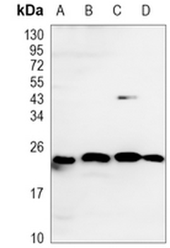 RhoA Rabbit Monoclonal Antibody