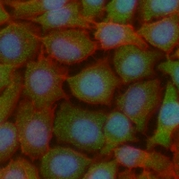 SMAD3 Rabbit Monoclonal Antibody