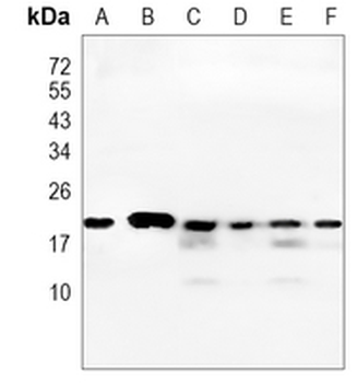 CDC42 Rabbit Monoclonal Antibody