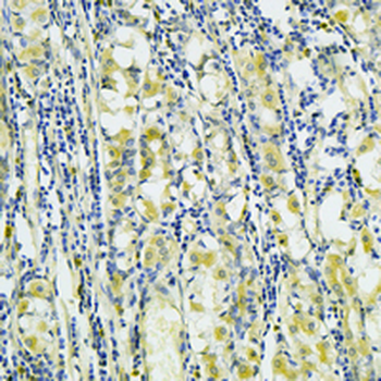 CDC42 Rabbit Monoclonal Antibody