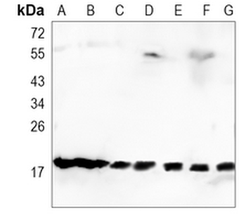 UBC9 Rabbit Monoclonal Antibody