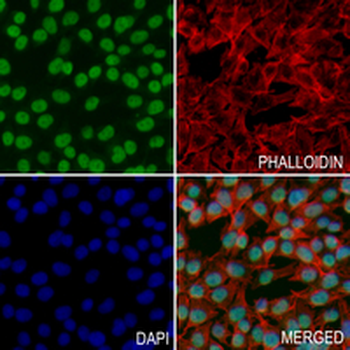 UBC9 Rabbit Monoclonal Antibody