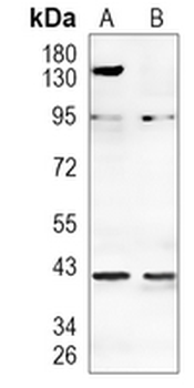 PRMT1 Rabbit Monoclonal Antibody