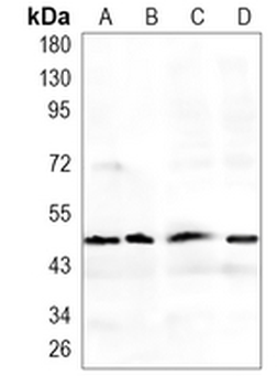 ERp5 Rabbit Monoclonal Antibody