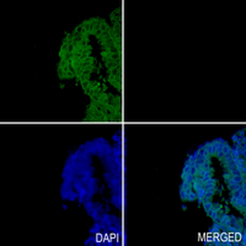 ARHGAP26 Rabbit Monoclonal Antibody