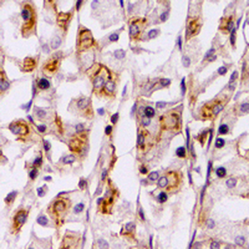 PTEN Rabbit Monoclonal Antibody