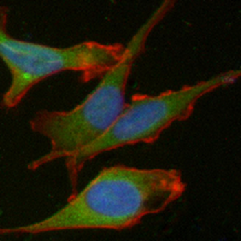 PTEN Rabbit Monoclonal Antibody
