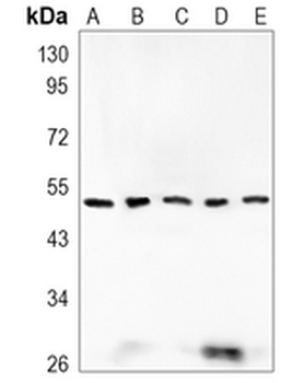 ILK Rabbit Monoclonal Antibody