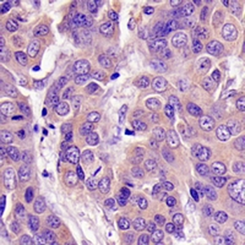 TP-1 Rabbit Monoclonal Antibody