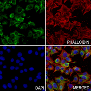 TP-1 Rabbit Monoclonal Antibody