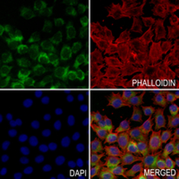 NDUFB4 Rabbit Monoclonal Antibody