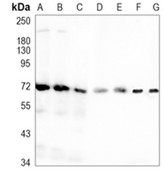 PRMT5 Rabbit Monoclonal Antibody