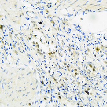 PRMT5 Rabbit Monoclonal Antibody