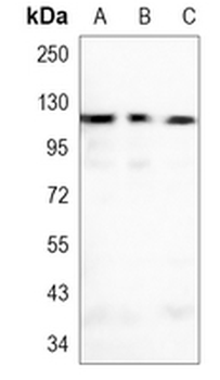 Focal Adhesion Kinase Rabbit Monoclonal Antibody