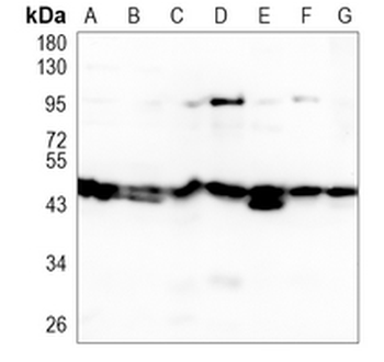 PSMC4 Rabbit Monoclonal Antibody