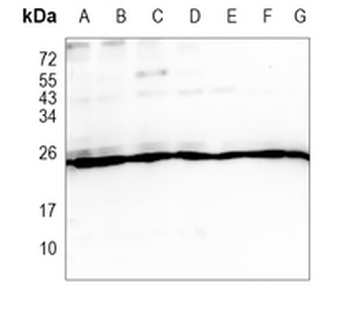 PSMA2 Rabbit Monoclonal Antibody