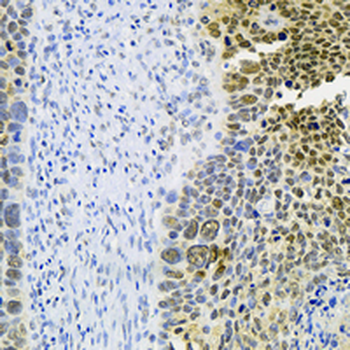 USP39 Rabbit Monoclonal Antibody