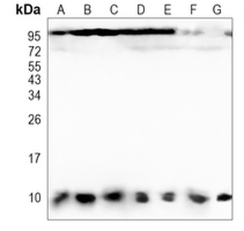 DYNLL1 Rabbit Monoclonal Antibody