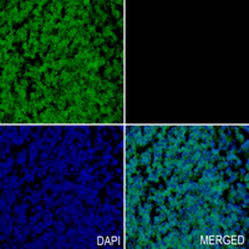 DYNLL1 Rabbit Monoclonal Antibody