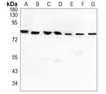 CD168 Rabbit Monoclonal Antibody