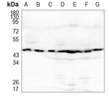 Citrate Synthase Rabbit Monoclonal Antibody