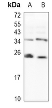 RAB5A Rabbit Monoclonal Antibody