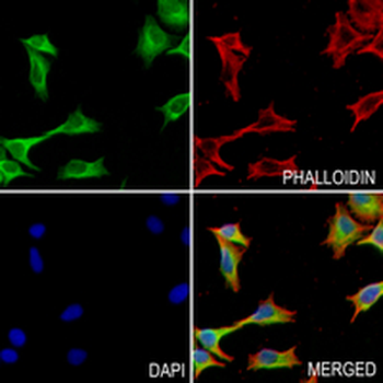 RAB5A Rabbit Monoclonal Antibody