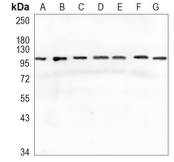 GART Rabbit Monoclonal Antibody