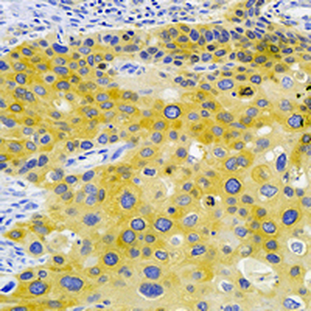 GART Rabbit Monoclonal Antibody
