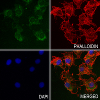 INMT Rabbit Monoclonal Antibody