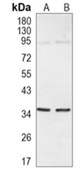 CD138 Rabbit Monoclonal Antibody