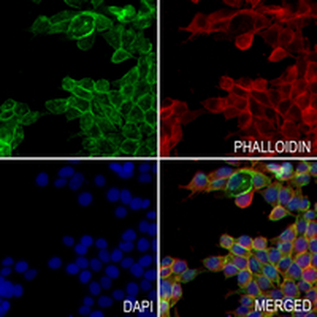 CD138 Rabbit Monoclonal Antibody