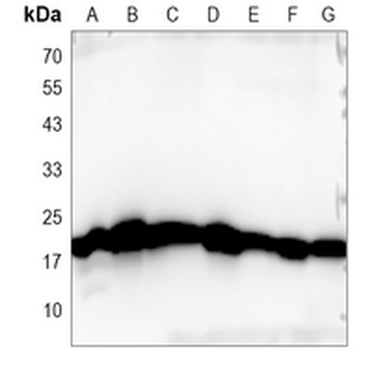 EMC4 Rabbit Monoclonal Antibody