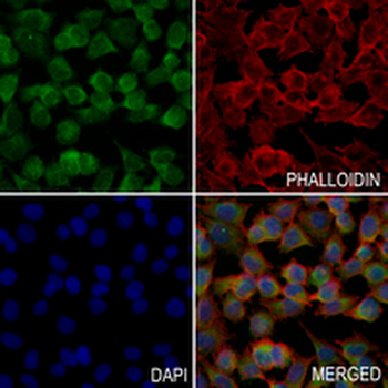 EMC4 Rabbit Monoclonal Antibody