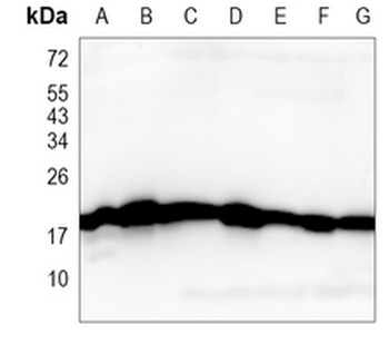 RKIP Rabbit Monoclonal Antibody