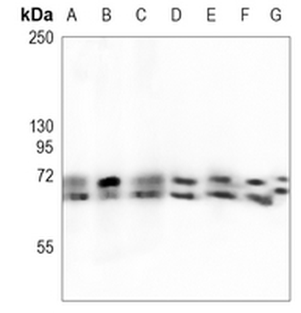 FMR1 Rabbit Monoclonal Antibody