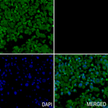 FMR1 Rabbit Monoclonal Antibody