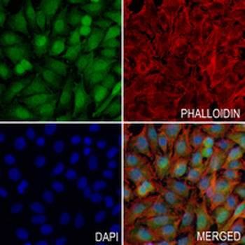 DHFR Rabbit Monoclonal Antibody