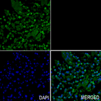 Cofilin Rabbit Monoclonal Antibody